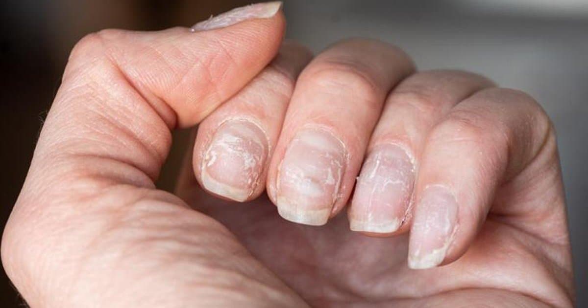 Zayıf Tırnaklara Doğal Çözüm: Pratik ve Etkili Yöntemler