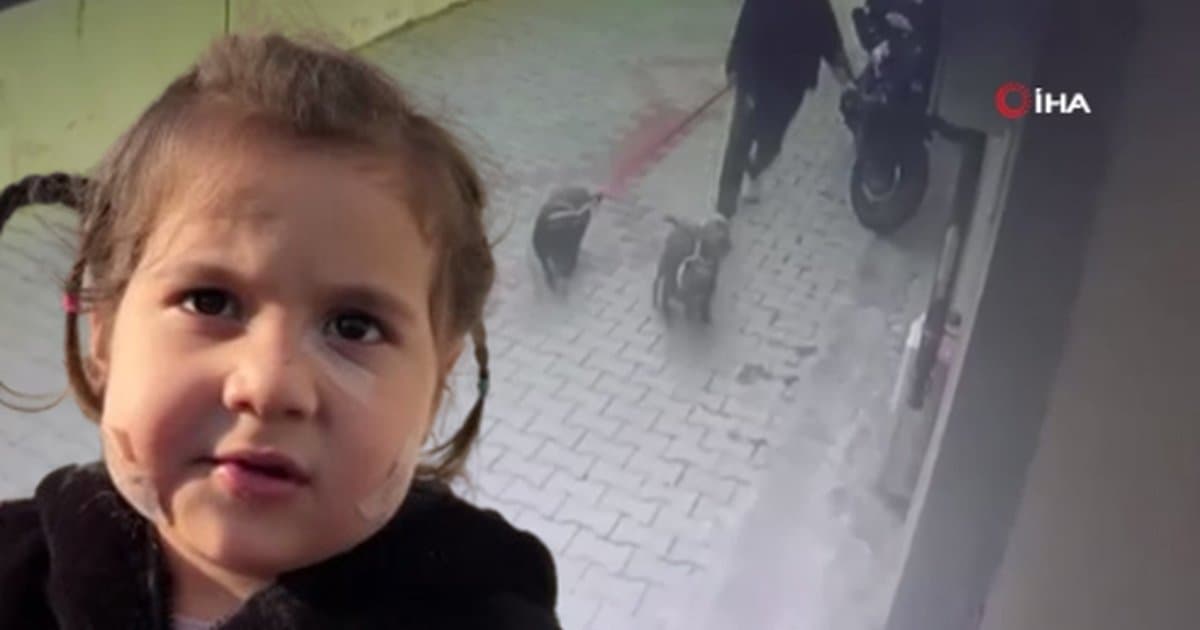 İzmir'de 3 yaşındaki çocuğa köpek saldırısı: Aile köpek sahibinden şikayetçi oldu