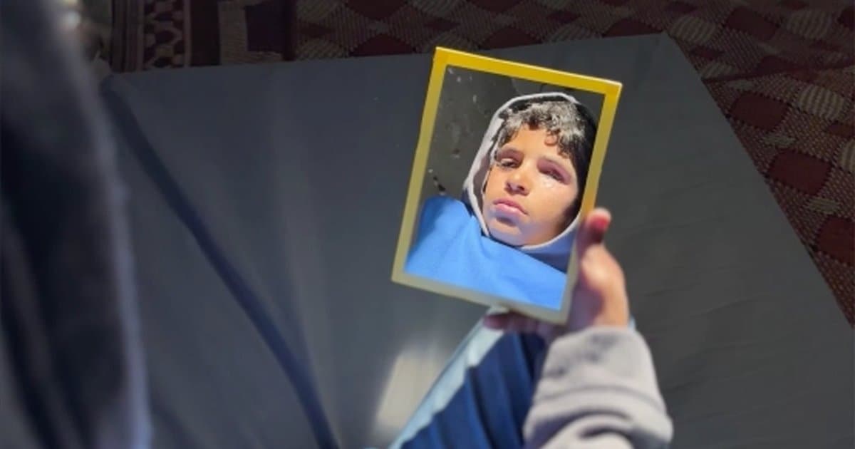 Gazze'de şarapnel nedeniyle gözünü kaybeden çocuk protez gözle hayatına dönmeyi umut ediyor
