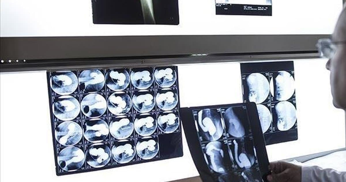 Sağlık Bakanlığı yapay zeka destekli Mamografi Tarama Raporlama Sistemi