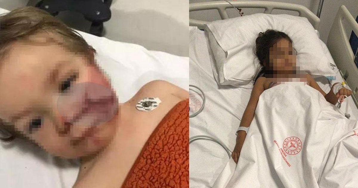 Ankara'da 2 kardeşe saldıran pitbullun sahibine tahliye