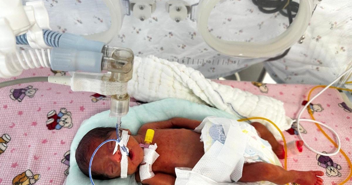 650 gramlık Leyla bebek mucizevi şekilde taburcu oldu