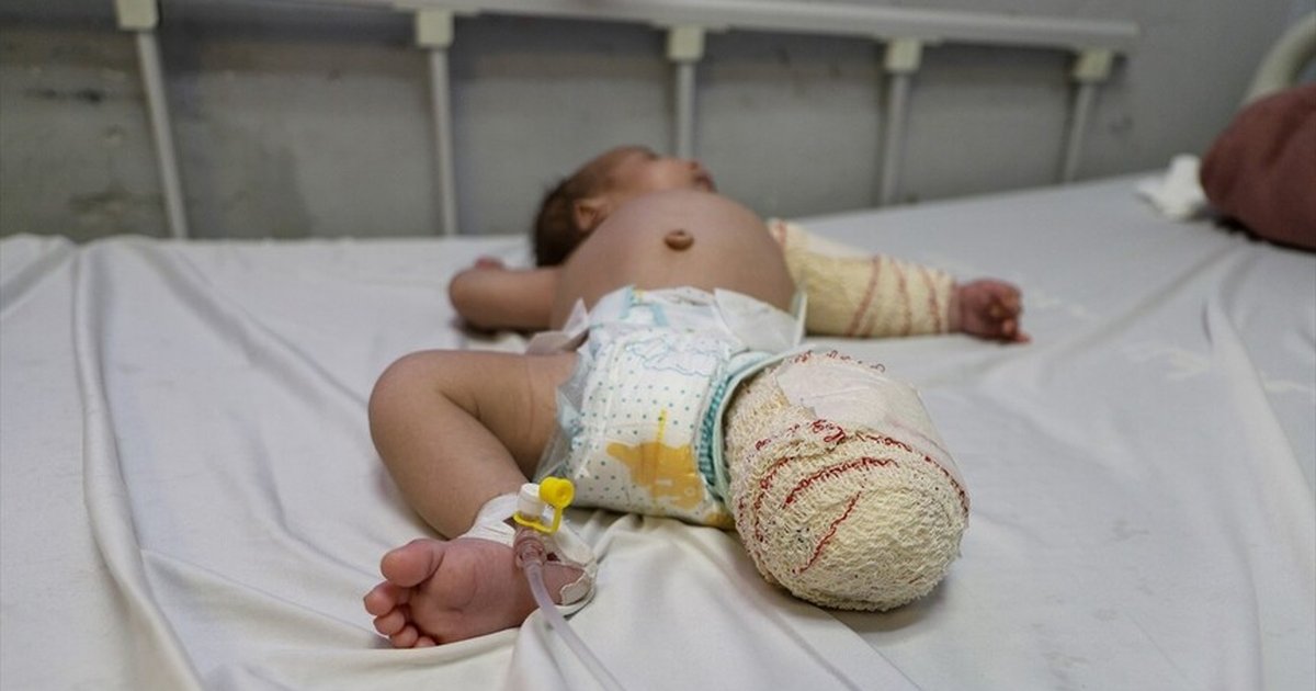 Gazze'de 50 günlük bebek Muhammed'in mücadelesi