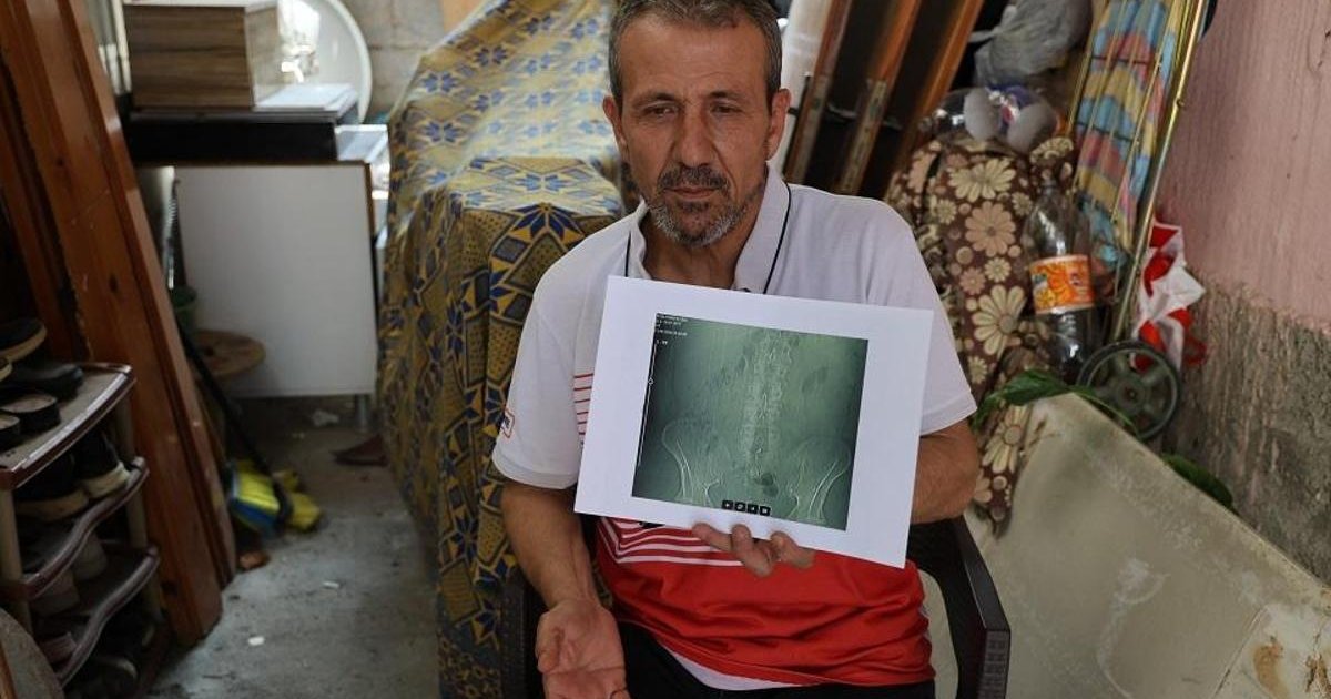 Adana'da ameliyat skandalı: Belinde 'panç' unutuldu