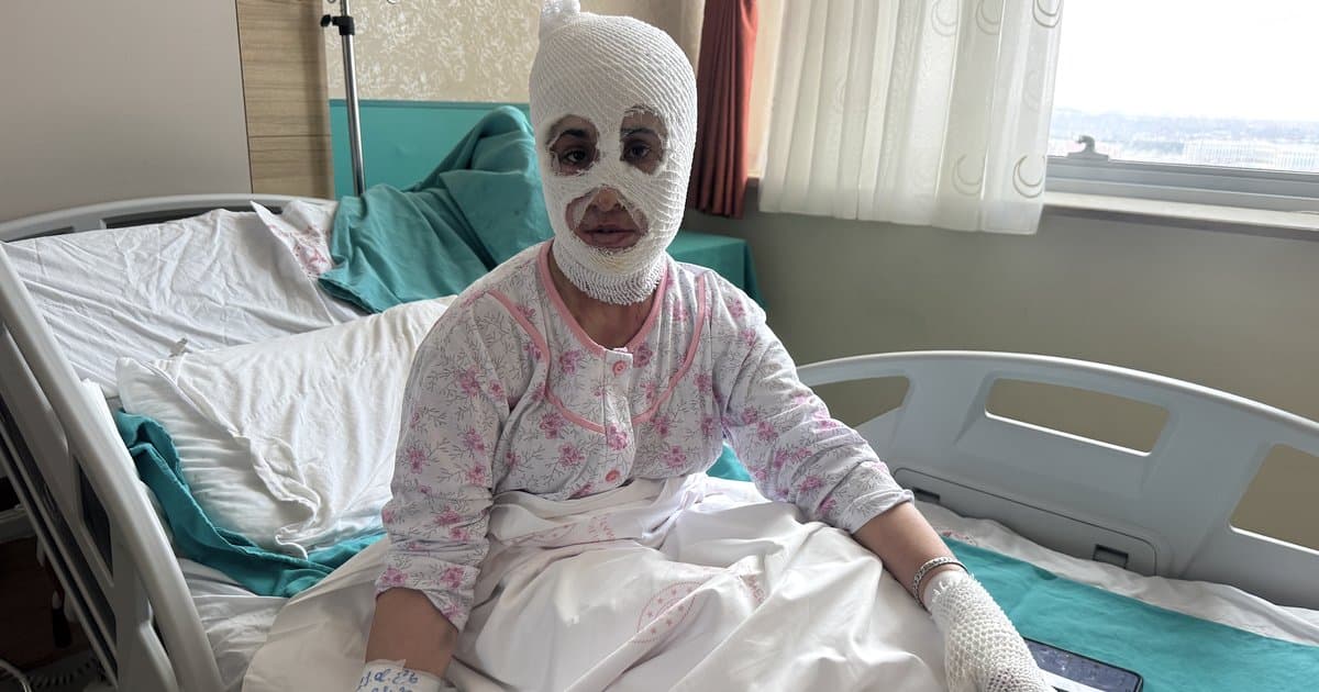 Ağrı'da İftar Hazırlığında Düdüklü Patladı: 2 Çocuk Annesi Hastanelik Oldu