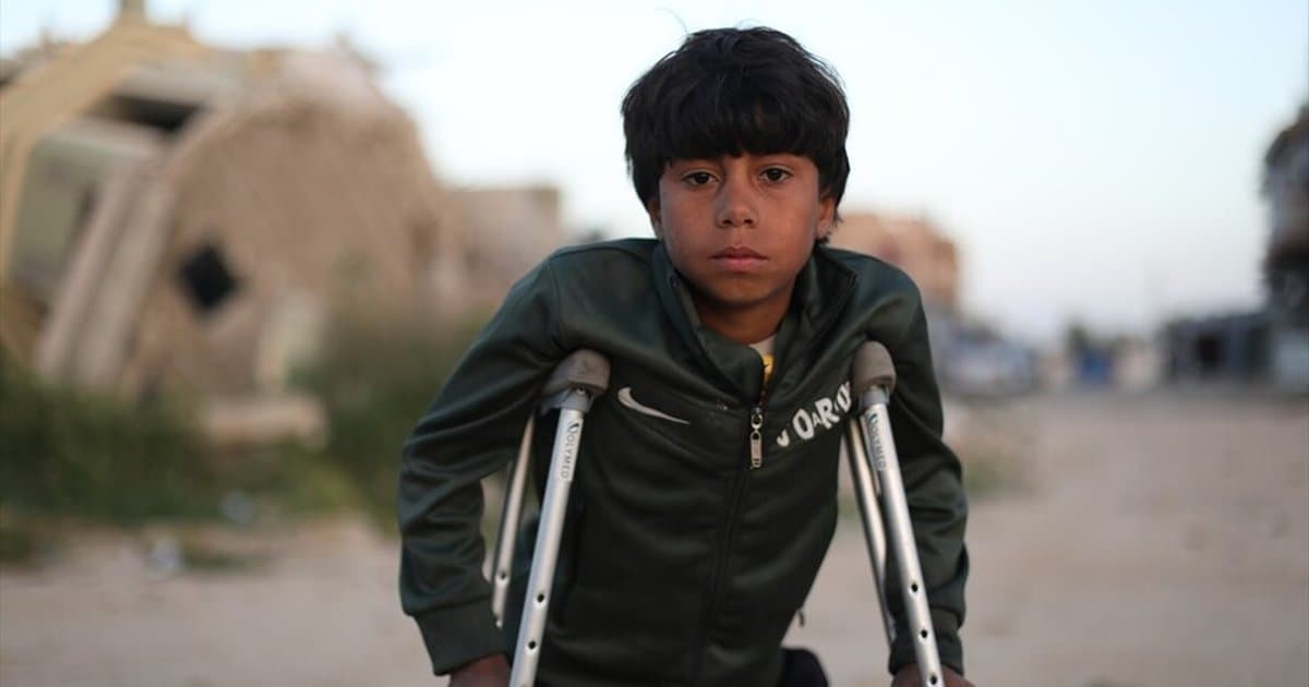 Gazze'de İsrail saldırısında yaralanan çocuk tedavi bekliyor