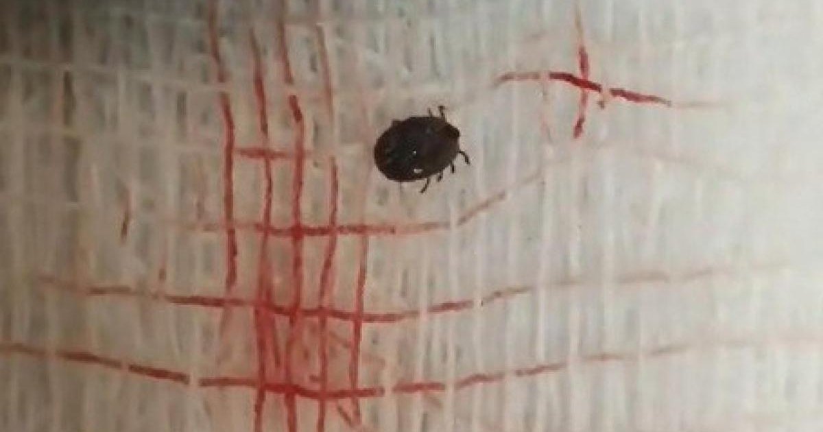 Tokat'ta kene ısırığı sonucu bir kişi yaşamını yitirdi