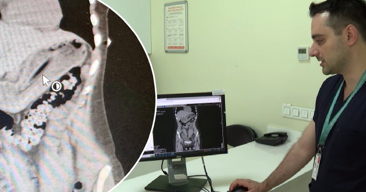 Zayıflamak için kendini kustururken diş fırçası yuttu!