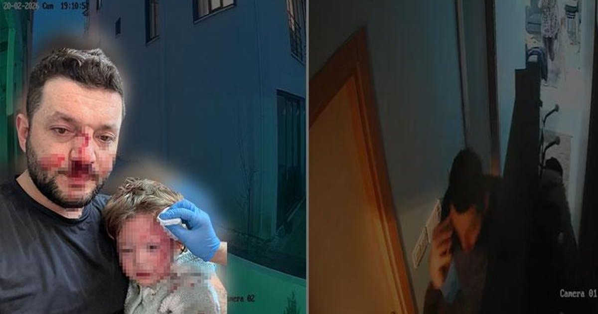 14 aylık İkra'nın kafatası çatlamıştı: Olayın güvenlik kamerası görüntüleri ortaya çıktı