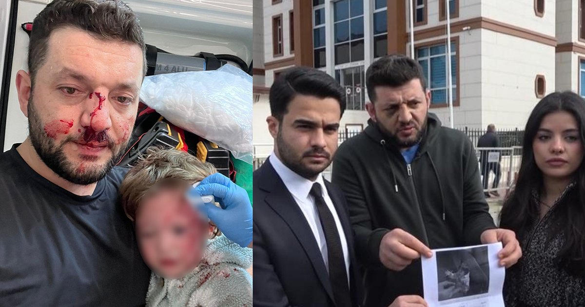 Yalova'da Baba ve 14 Aylık Kızına Saldırı