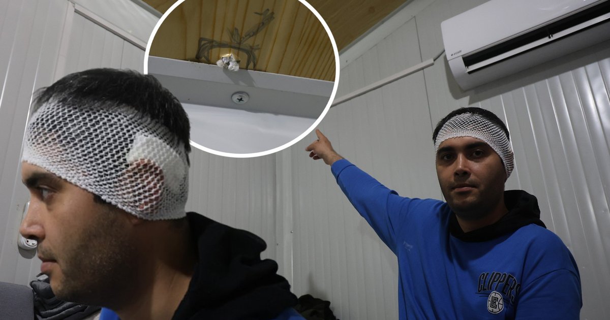 Hatay'da Güvenlik Görevlisinin Kafasına Yorgun Mermi İsabet Etti