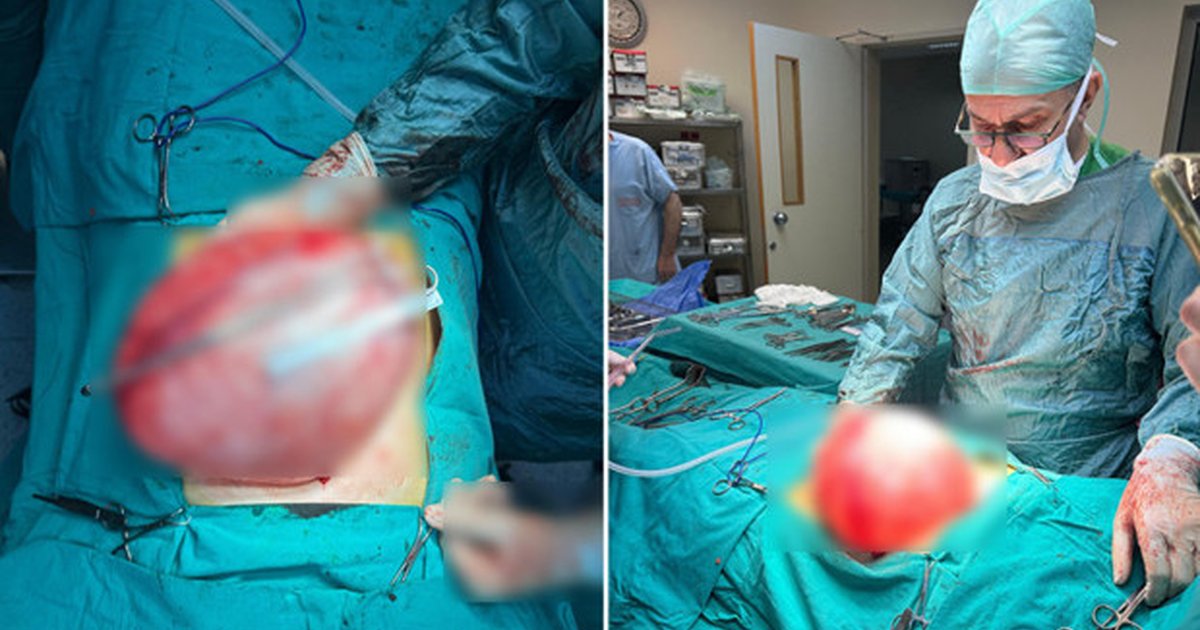 Bolu'da 14 yaşındaki çocuğun karnından 3,5 kiloluk kist çıktı