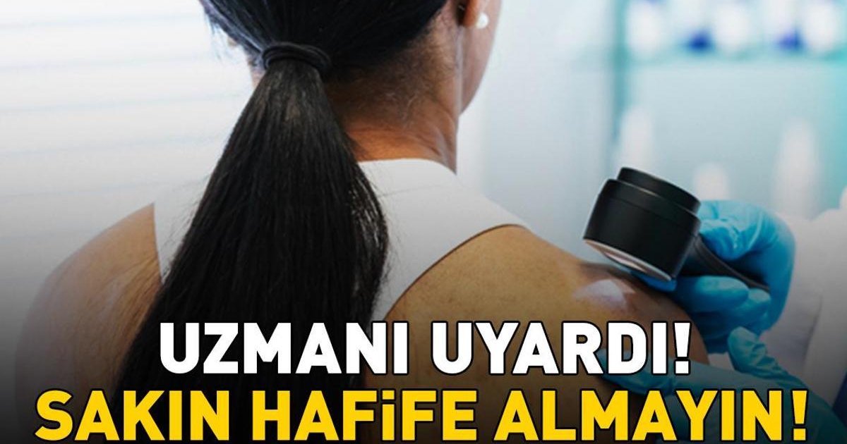 Cildinizdeki değişimleri hafife almayın! Deri kanseri uyarısı